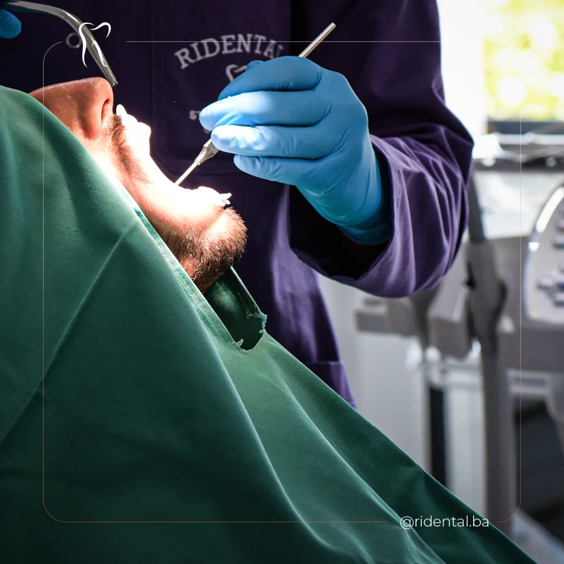 Protetika na implantatima u Cazinu – fiksni zubi na implantatima, ordinacija Ridental Ostrožac