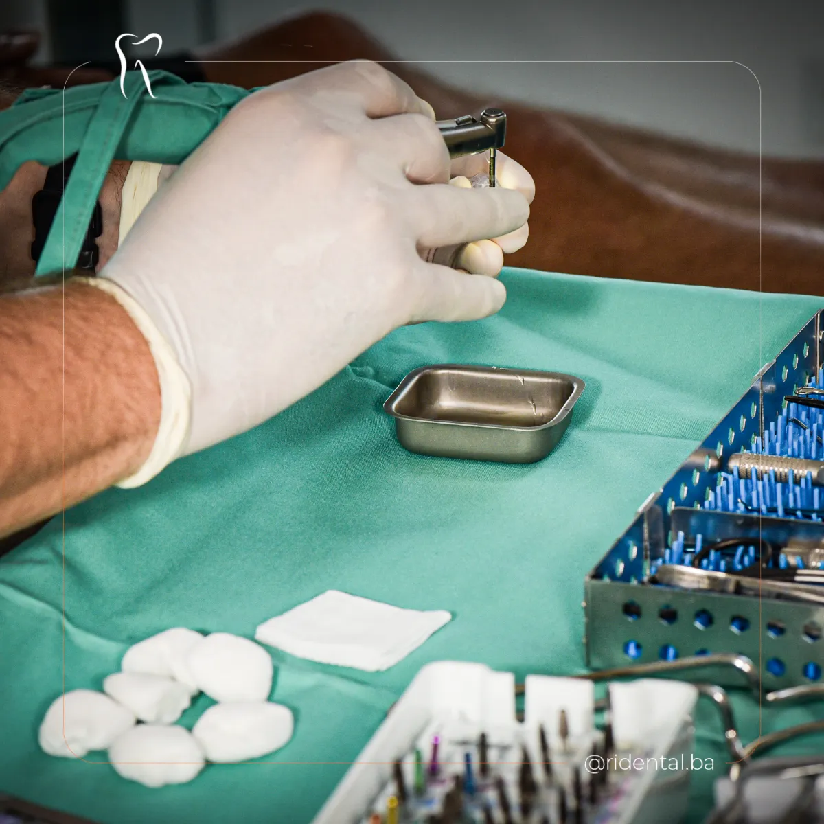 Priprema instrumenata za ugradnju zubnog implantata, Ridental Ostrožac